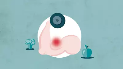 Exercícios de resistência, dor muscular e alimentação